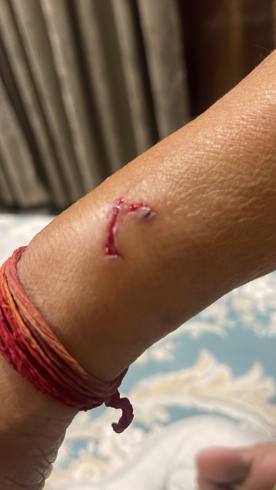 Stray Dogs Injure 5 in Sector 122, Noida